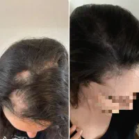 موهای سرتو دو روز پر پشت کن