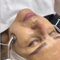فیشیال وپاکسازی پوست با دستگاه هیدرودرمی گالوانیک