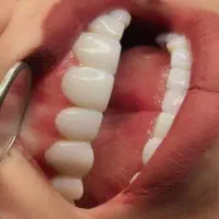 برای سال نو به خودت لبخندی زیبا هدیه بده