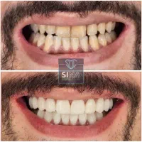 مرکز تخصصی دندانپزشکی سینا منطقه۱۸