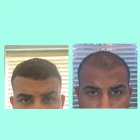 یه بار هزینه کن و نگرانیتو تا اخر عمر از بین ببر