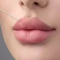 جشنواره ژل و بوتاکس