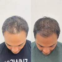 از جمع کچل ها بیا بیرون
