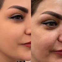 پنکک لاکچری کوین اصل وارداتی فرانسه تکاب