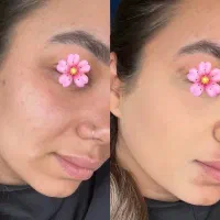 پنکک و کرم پودر لاکچری کوین