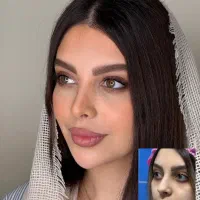 عمل بینی با پیزوسرجری باتخفیف استثنایی ۵۰٪ درتهران