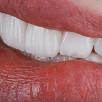 دندانپزشکی
