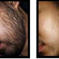 ریش دار شوی تا ریشه دار شوی