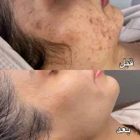 دوره جامع و تخصصی پوست و فیشال