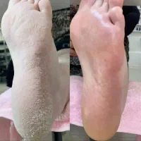 پدیکور تخصصی پا