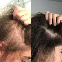 به تارهای موهات فرصت درخشش و حجم بده