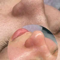 تخفیف به مناسبت اعیادفشیال و پاکسازی