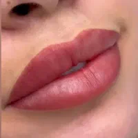 زیبایی لیزر تزریق بوتاکس و فیلر ژل و بلفاروپلاستی