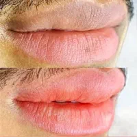 رفع تیرگی لب آقایان