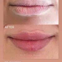 اپراتور لیزر