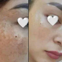 سفید و بی لک شو تضمینی