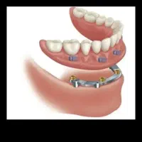 دندانپزشکی زهره ((اقساطی))