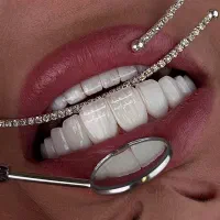 هم اقساط هم تخفیف دندانپزشکی /ایمپلنت با ضمانت