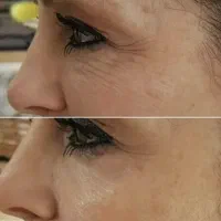 کرم ۵ کاره گاتیو بیوممتیک