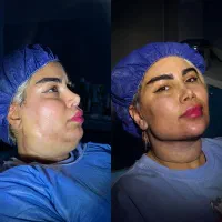 فقط و فقط با ۱۰/۹۰۰ غبغبت رو تخلیه کن