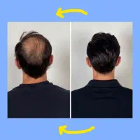 برگشت اعتماد بنفس