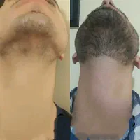 تا کی میخوایی بی ریش بمونی