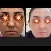 کرم درخشان(قویترین ضد لک،روشن کننده)ارسال رایگان