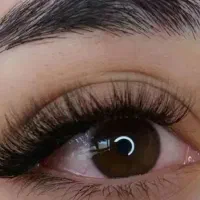 کاشت هیدن