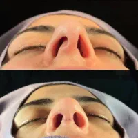 متناسب چهره،طببیعی .نیمه فانتزی ،اقساطی.کرمانشاه