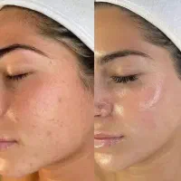 فشیال تخصصی ودرمانی هداسپا،اسکالپ ۵۰ درصدتخفیف