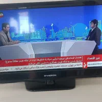 تلویزیون ایکس ویژن