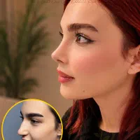 عمل زیبایی بینی 52 م از دم قسط و با چک صیادی