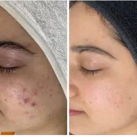 خدمات زیبایی VIP تخصصی ژورنالی در صدرا در صدرا-فارس، فاز ۱، بلوار مولانا