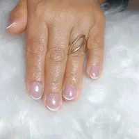 کاشت و ترمیم حرفه ای