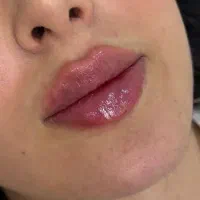 مدل ژل لب فقط هزینه مواد فوری فقط تا آخر هفته