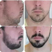 روغن تراپی