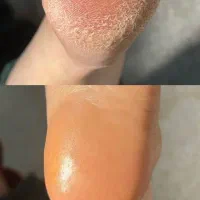 مدل پدیکور با قیمت ویژه