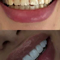 دندانپزشکی-اقساط
