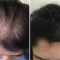 این اقدام آخریشه زود باش