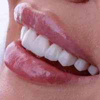 جشنواره دندانپزشکی