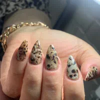 کاشت ژل و پودر و ترمیم