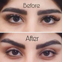 بلفارو،دایرکت ابرو،میدفیس،ساکشن اقساطی