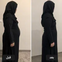حذف چربی های موضعی و لاغری با دستگاه