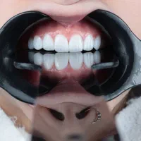 کلینیک دندانپزشکی لونا با بورد تخصصی کانادا