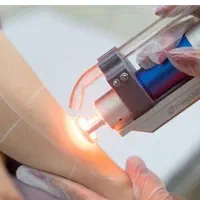 خدمات تخصصی لیزر با دو دستگاه نوبلکس و سوپرانو آیس