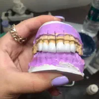 اموزش دندان کامپوزیت