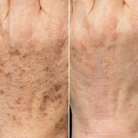 آموزشگاه پاکسازی پوست مو و زیبایی مینا فام