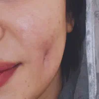 لبخندتو زیباتر کن