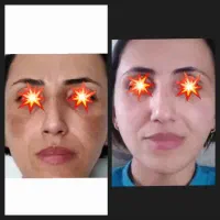 کرم ضدلک و روشن کننده درخشان