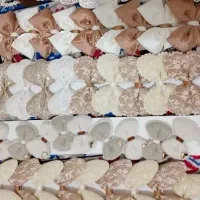 کش مو عمده